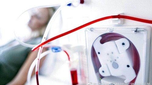 血液透析濃縮液中醋酸根含量分析